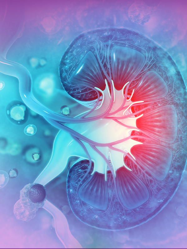 Role of Cytoreductive Nephrectomy in Advanced Renal Cancers