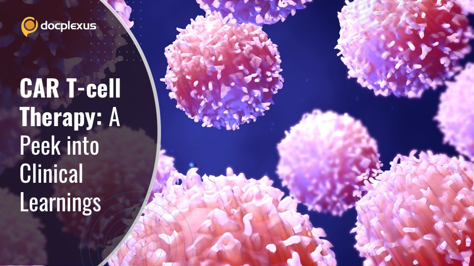 CD19 CAR T-cell Therapy: A Brief on Clinical and Real-world Data