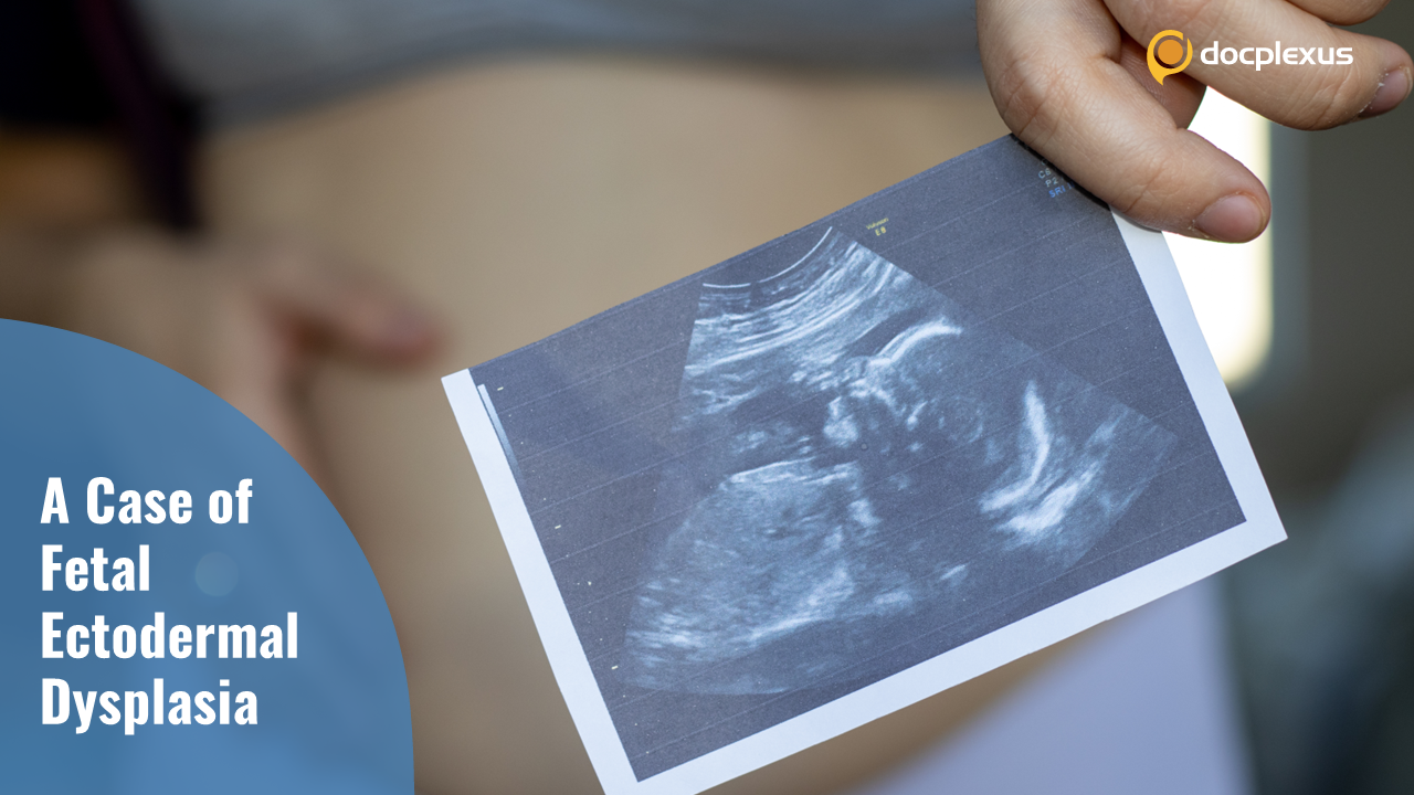 A Rare Case of Fetal Development Disorder