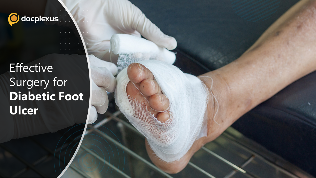 Proactive and Inexpensive DFU Surgery