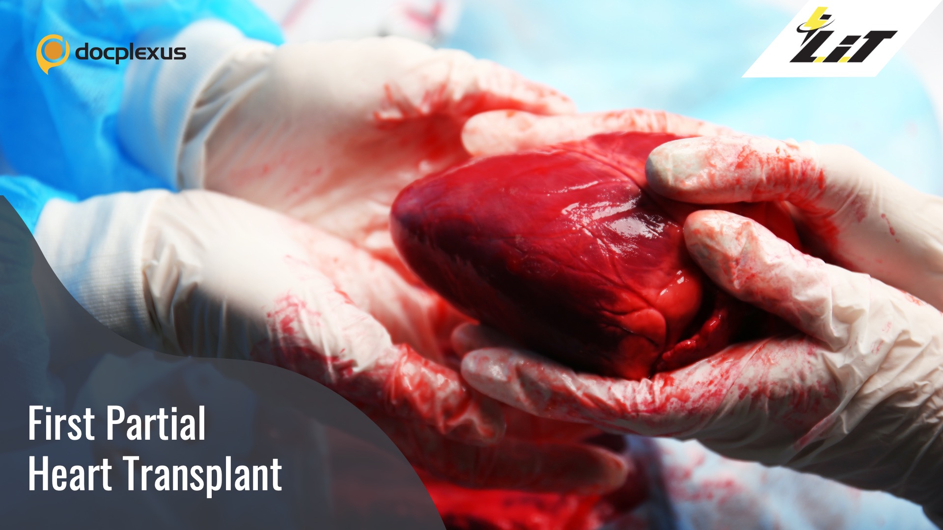 World’s First Partial Heart Transplant in a Newborn
