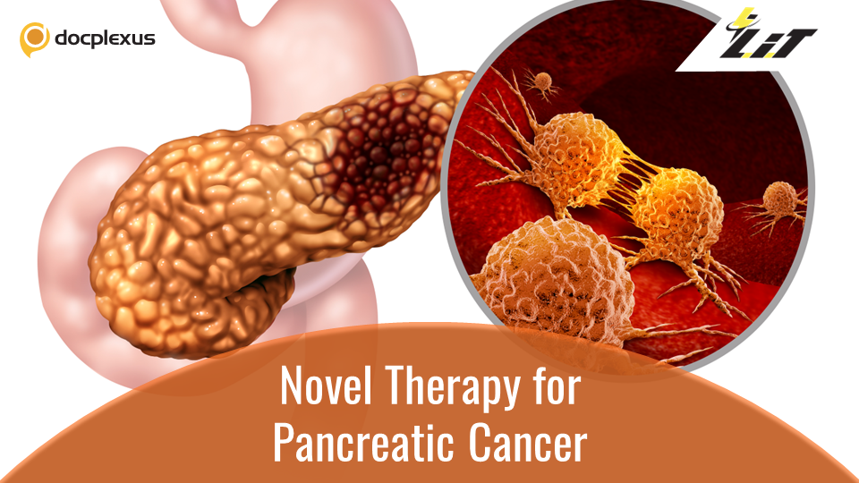 Novel Biomarker for Treating Lethal Pancreatic Cancer