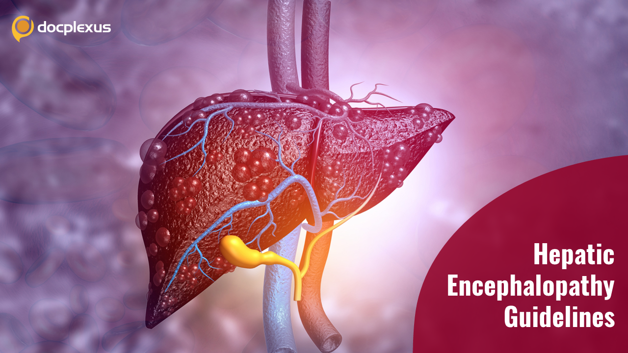 Hepatic Encephalopathy Management: EASL Guidelines