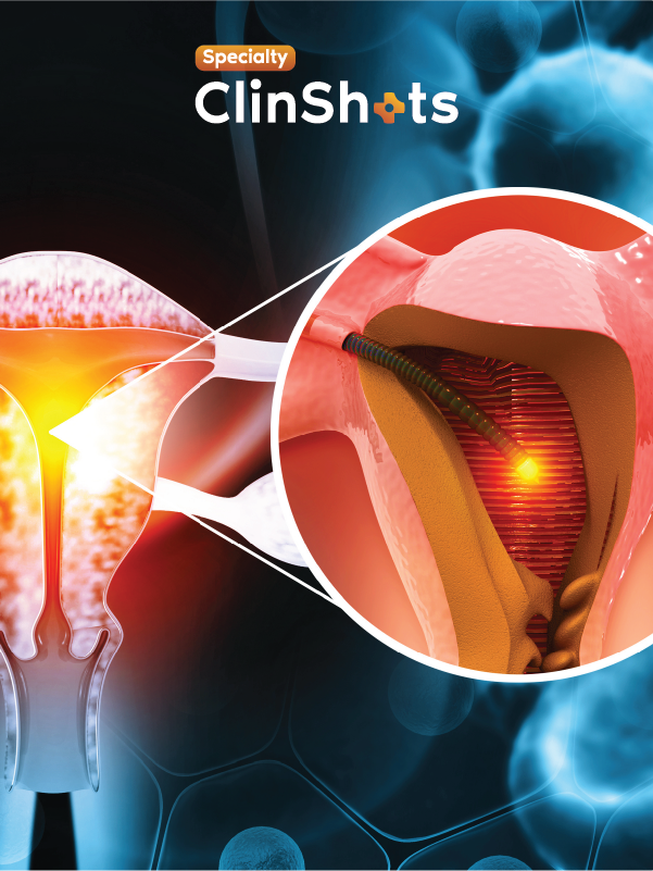 Systematic Therapy in Endometrial Cancers