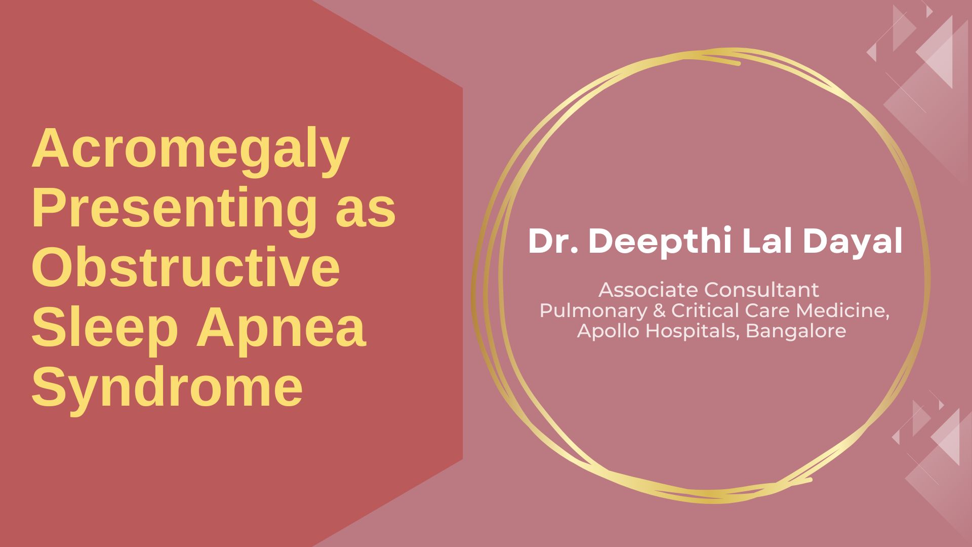Acromegaly Presenting As Obstructive Sleep Apnea Syndrome