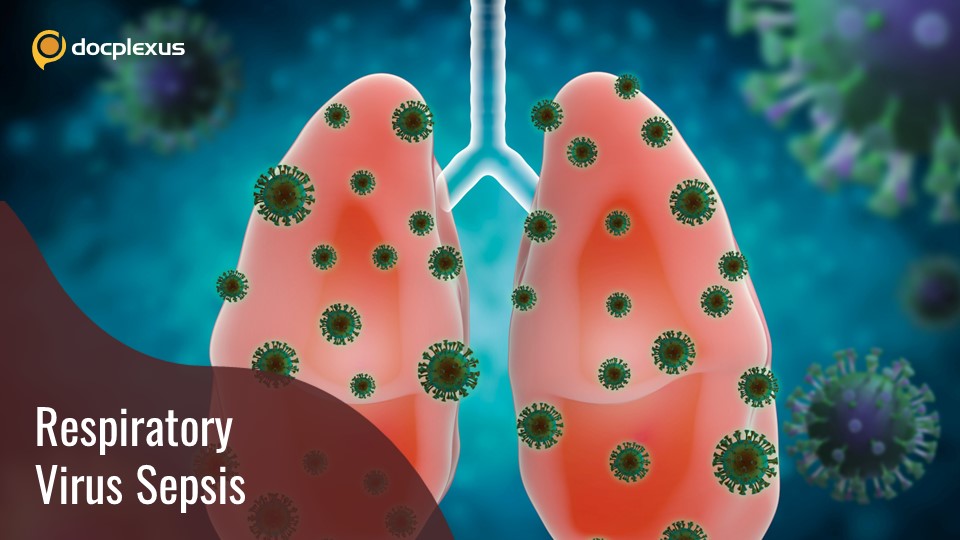 Respiratory Viral Sepsis: Diagnosis and Treatment