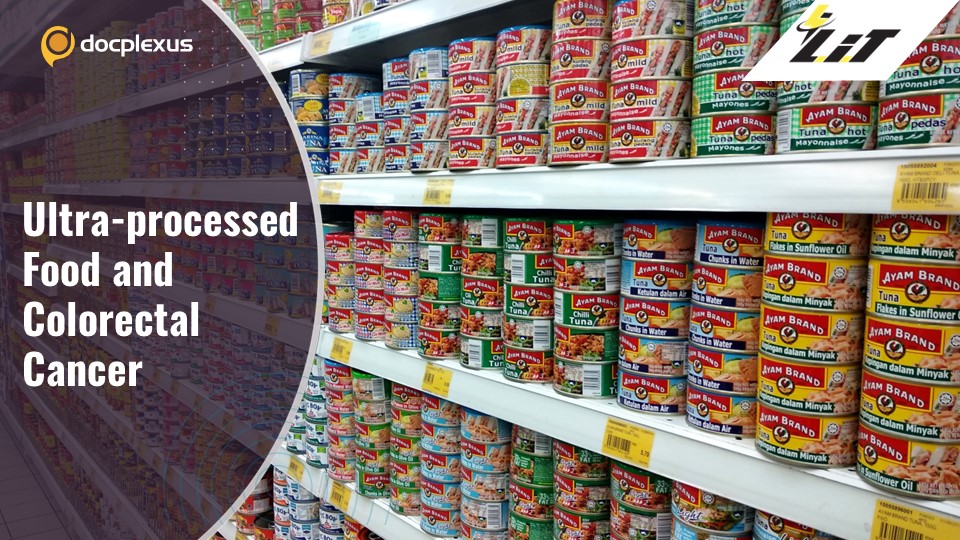 Are Ultra-processed Foods Linked with Colorectal Cancer?