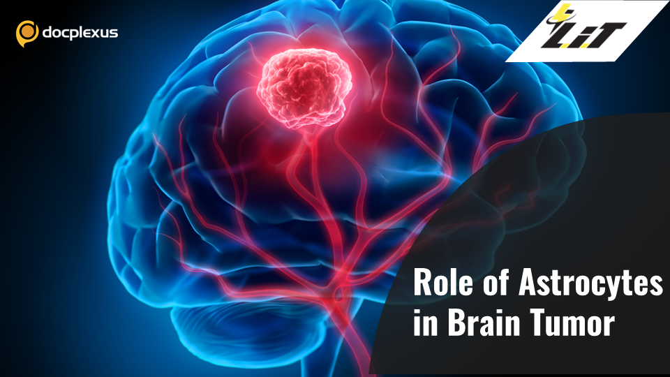 Potential New Treatment for Glioblastoma