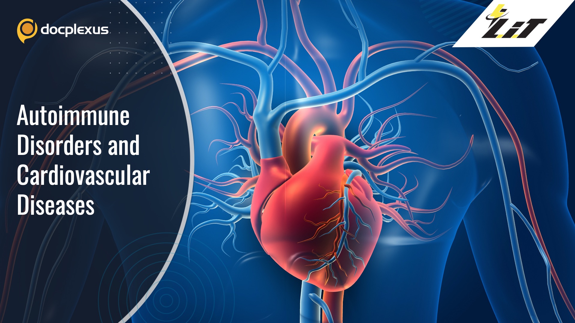 Can Autoimmune Disorders Impact Cardiovascular Health?
