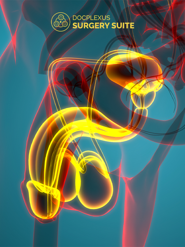 Primary Hypospadias