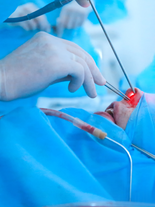 Endoscopic Facial Rejuvenation- The Next Level