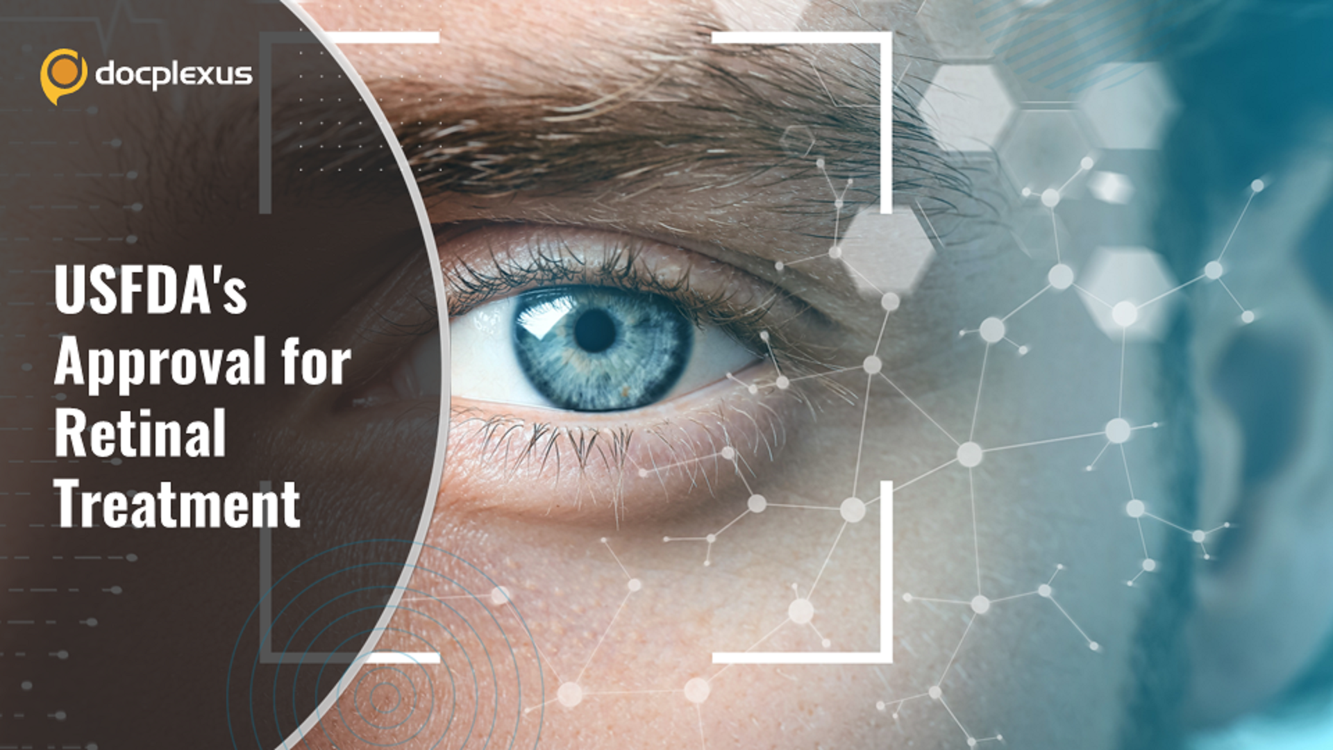 USFDA Approves a Biosimilar for Retinal Treatment