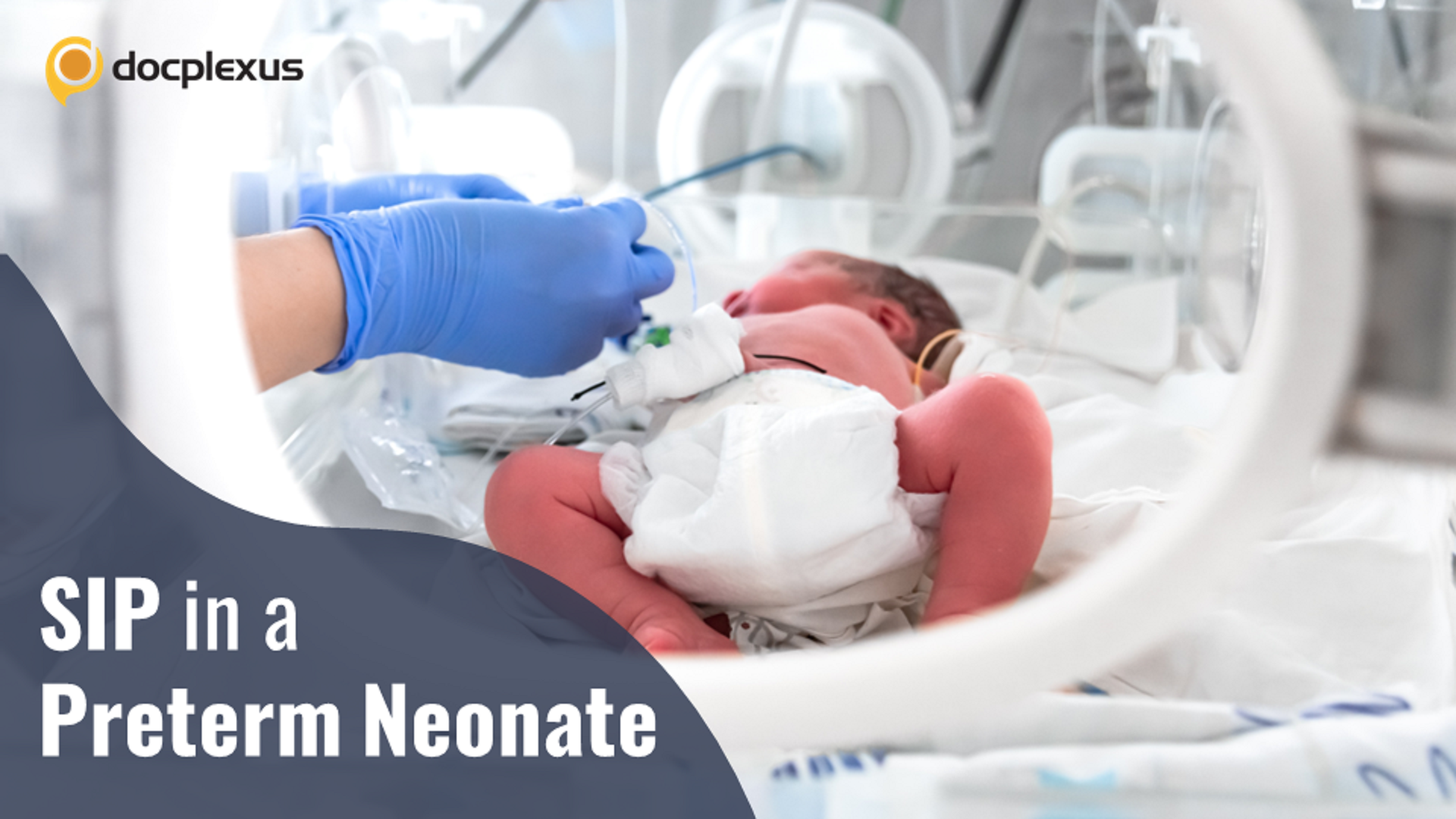 An Interesting Case of Spontaneous Intestinal Perforation in a Preterm Neonate