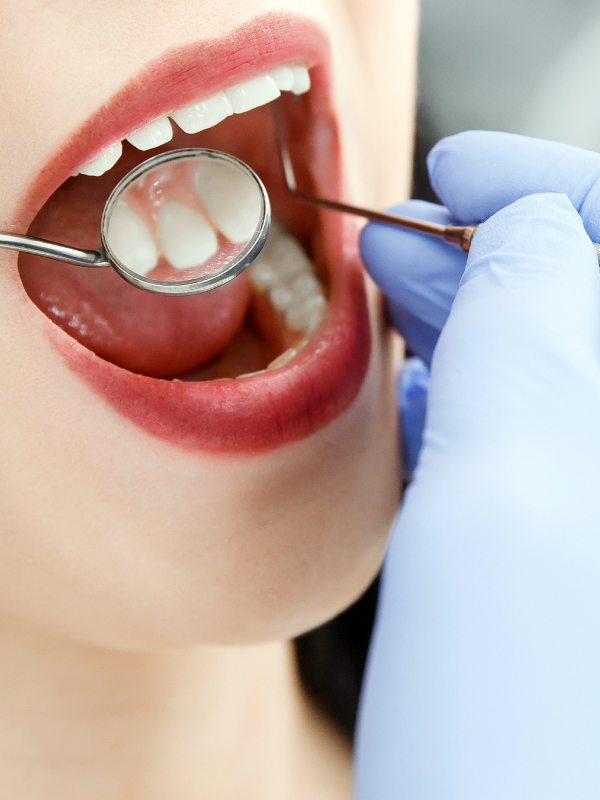 Perio Plastic Surgeries in Everyday Practice