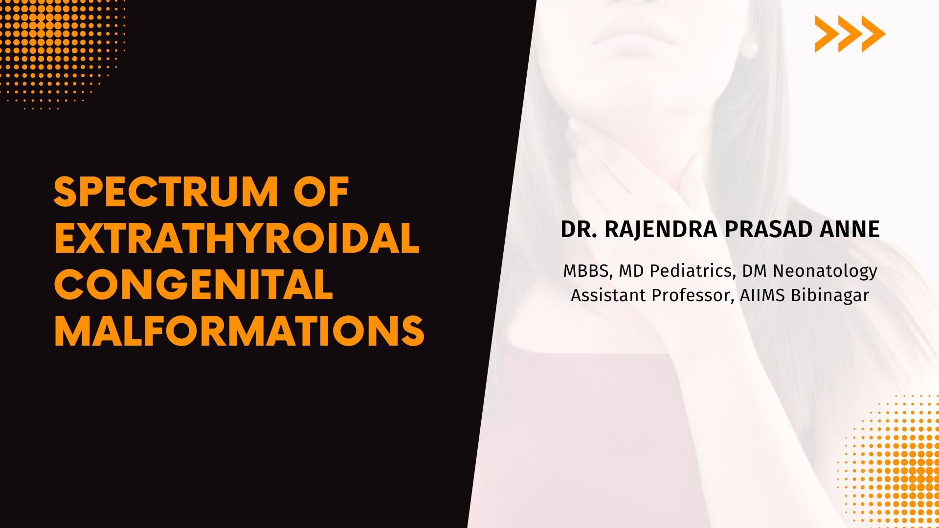 Spectrum of Extrathyroidal Congenital Malformations in A Cohort of North Indian Children with Permanent Primary Congenital Hypothyroidism