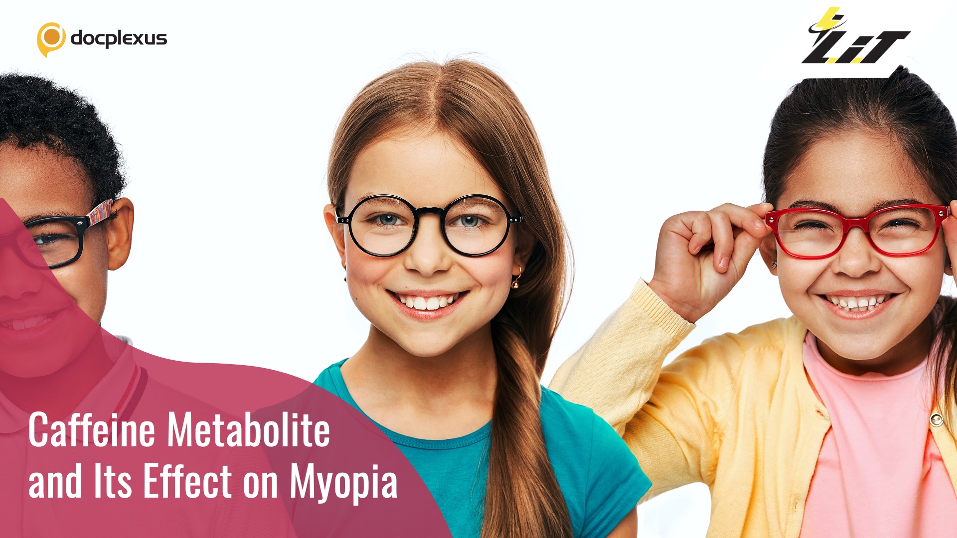 Caffeine Metabolite Reduces Myopia Progression in Children
