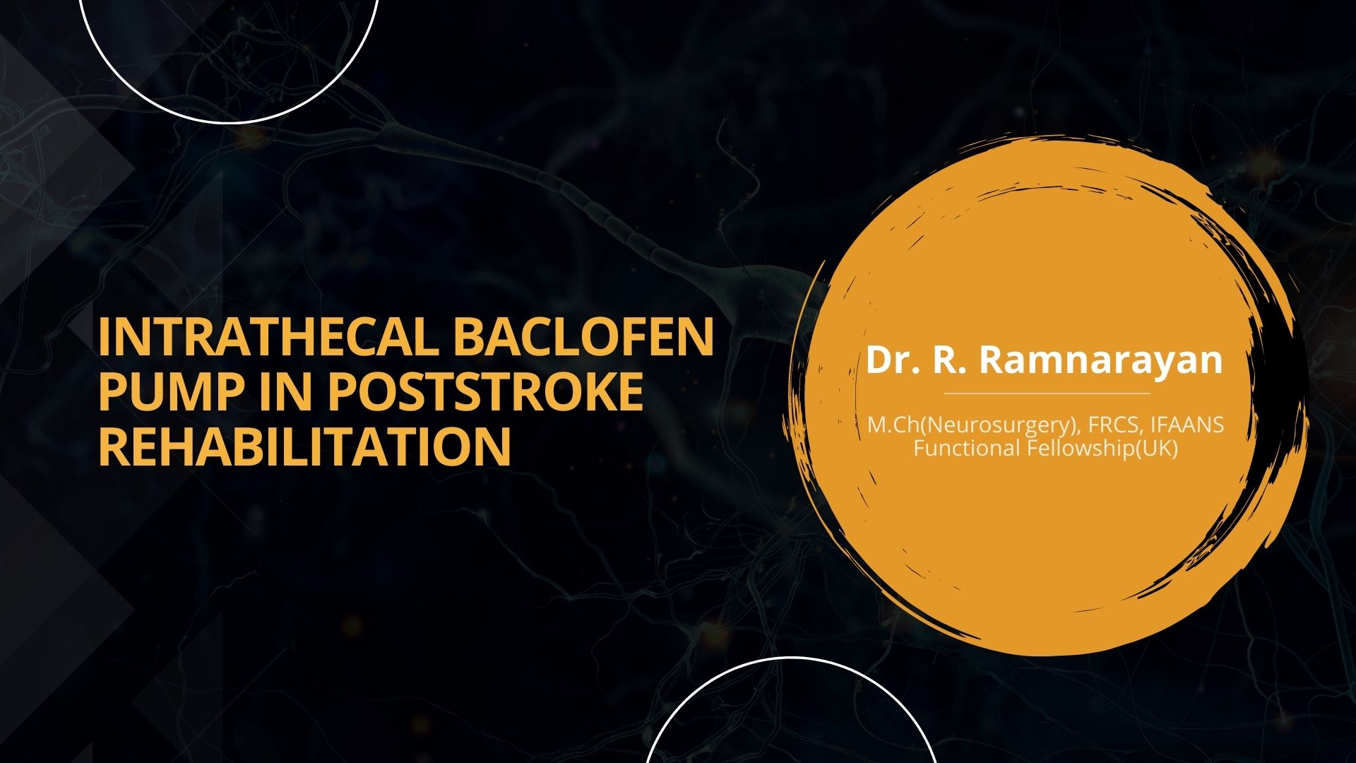 Intrathecal Baclofen Pump in Post-stroke Rehabilitation : Our Experience