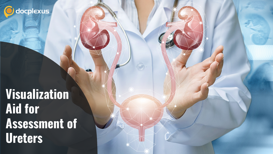 FDA Approves Indigotindisulfonate Sodium for Assessment of Ureters