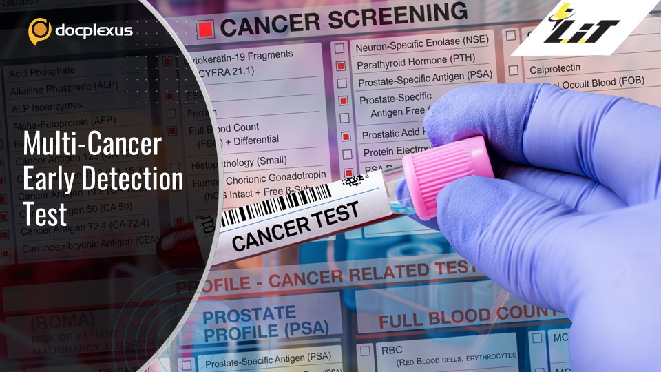Revolutionary Blood Test for Early Cancer Detection