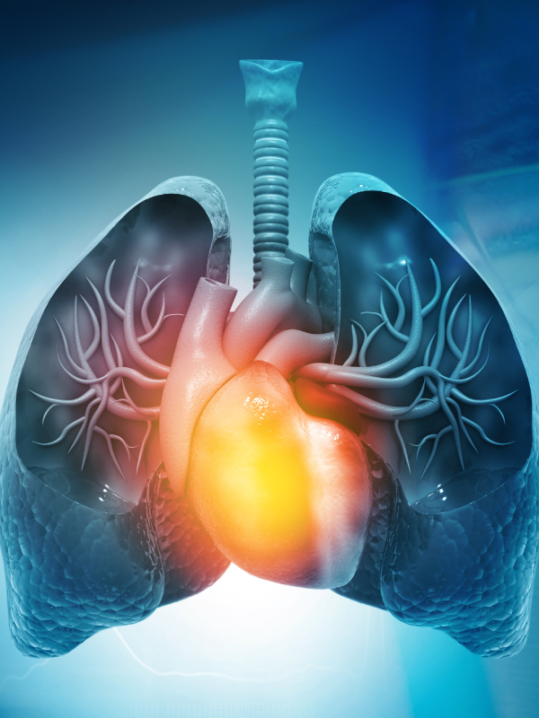 Transplant and Pulmonary Hypertension