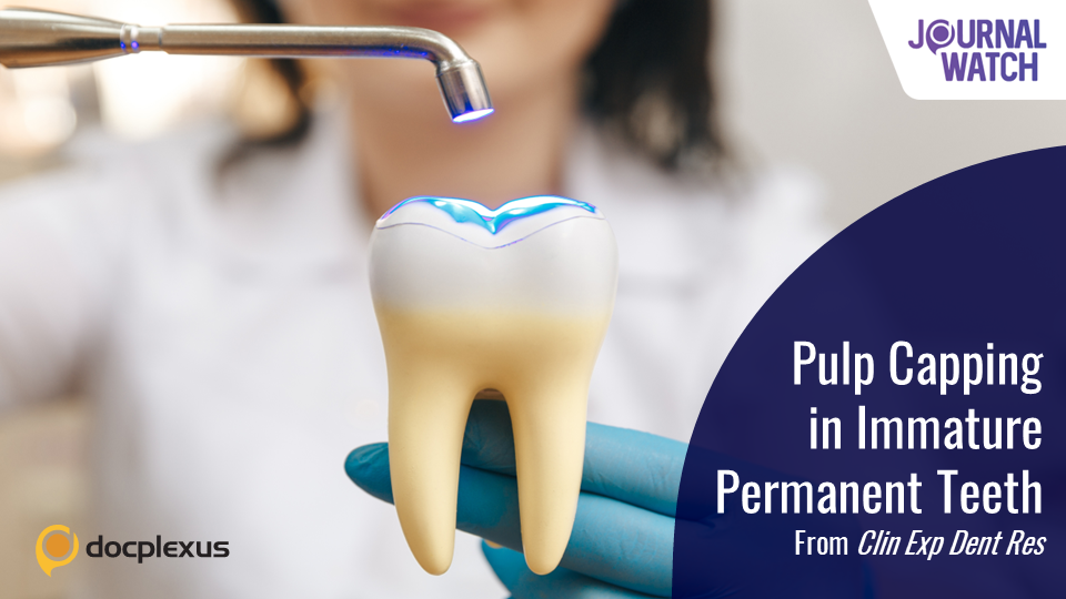 Indirect vs Direct Pulp Capping for Permanent Immature Teeth