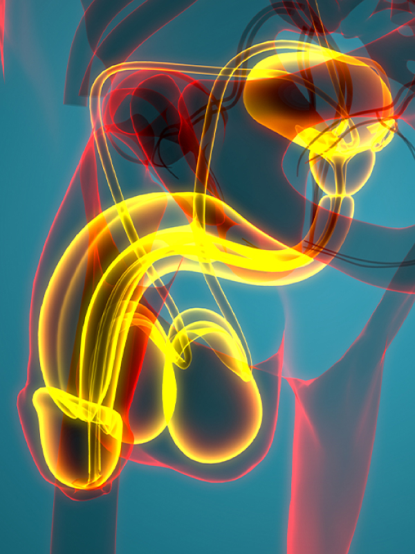 Primary Hypospadias