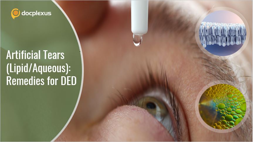 Comparison of Aqueous-based and Lipid-based Artificial Tears: A Randomized Controlled Trial