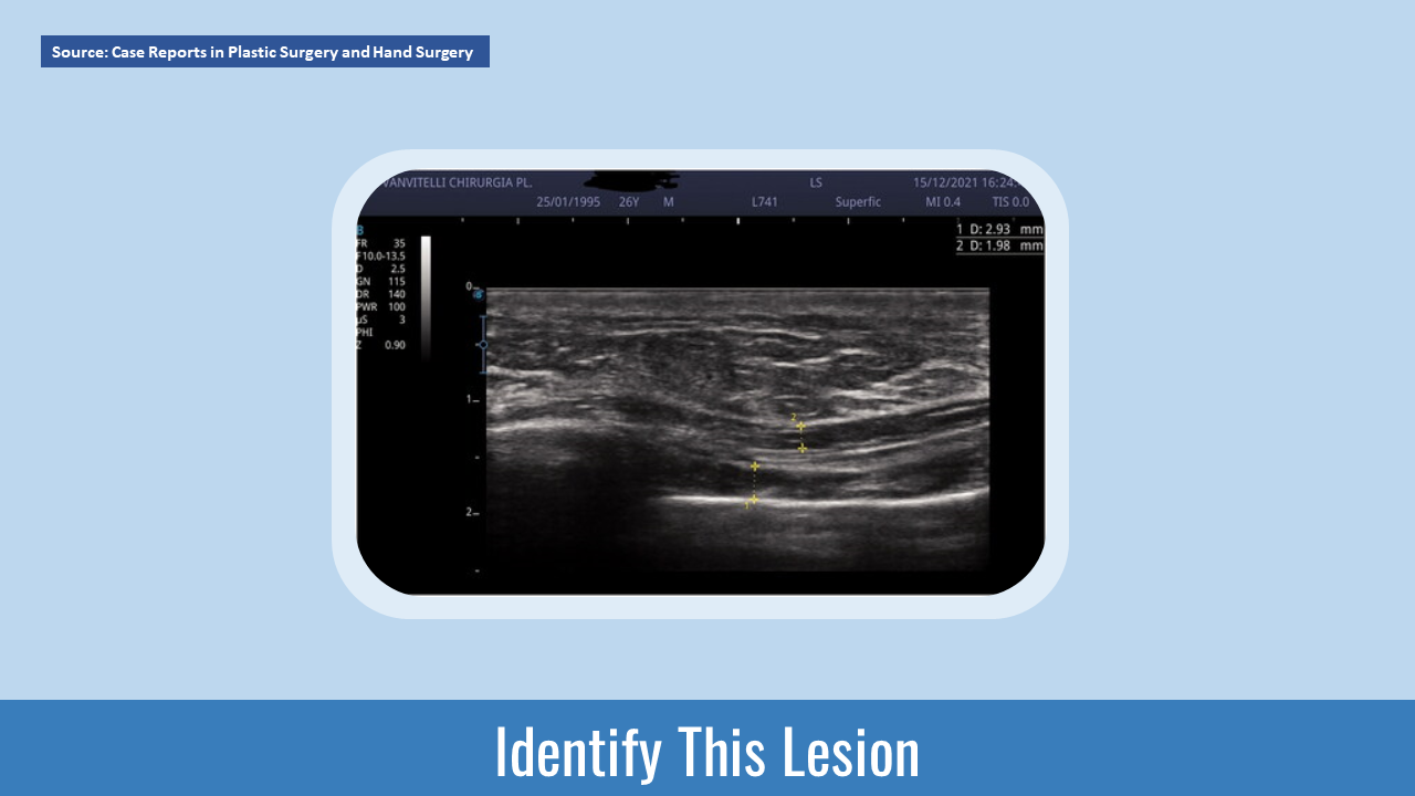 Can You Diagnose this  Condition?