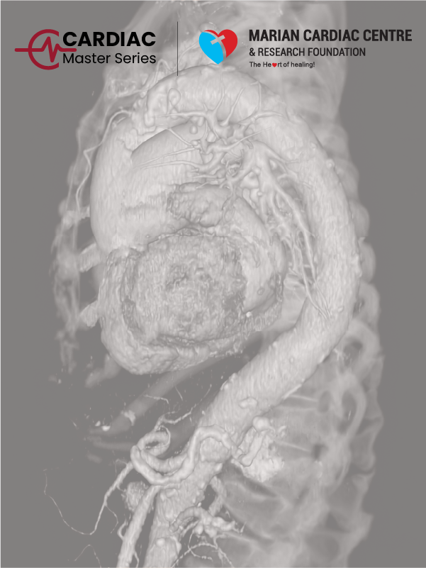 Management of Complex Aortic Pathologies