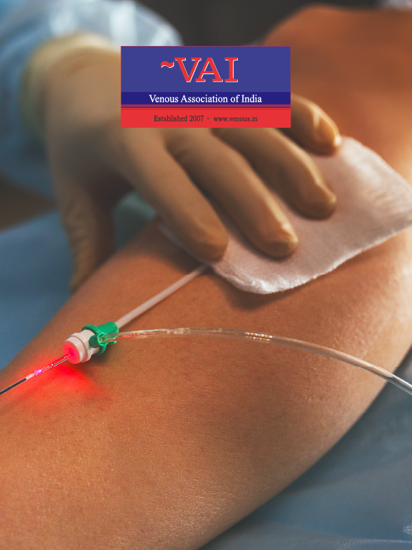 Endovascular Treatment for Prevention and Treatment of the Post-thrombotic Syndrome
