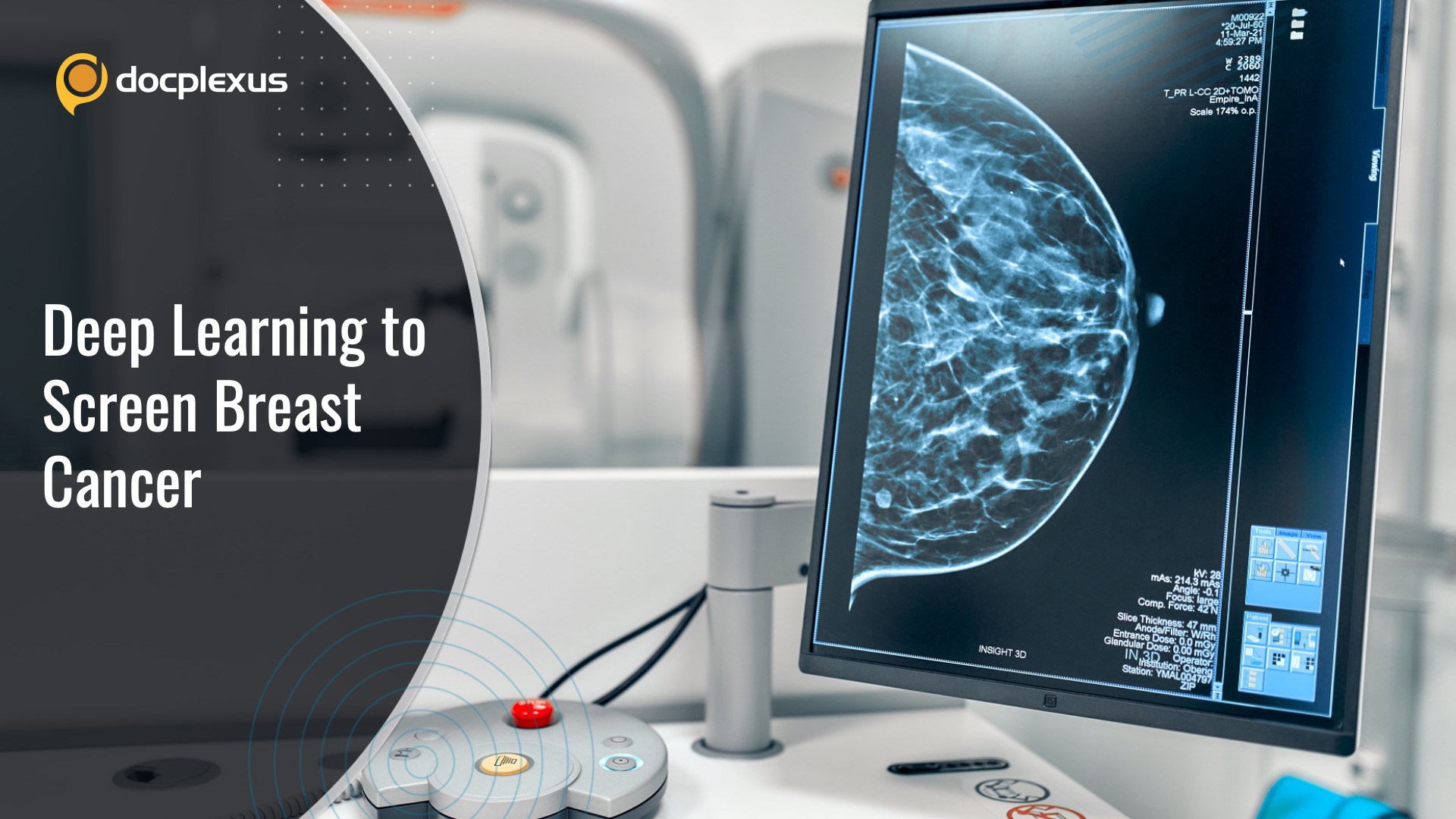 Can Deep Learning Approach Outperform Radiologists in Detecting Breast Cancer?
