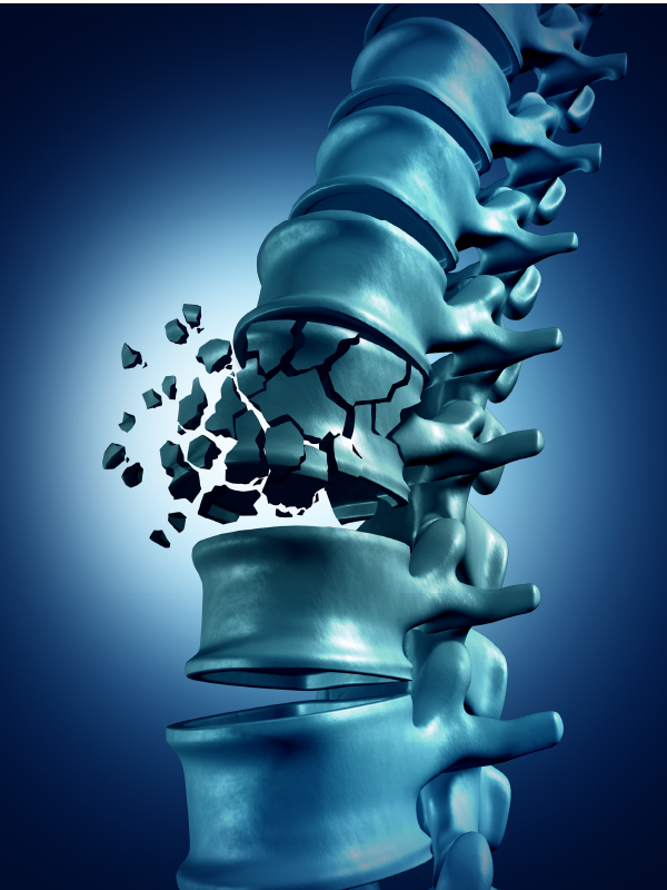 World Osteoporosis Day 2022