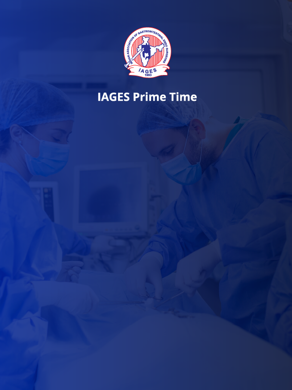 Single Fire Stapler - Sleeve Gastrectomy