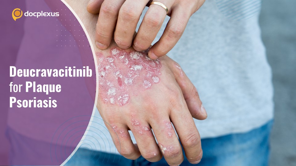 USFDA Approves Treatment for Plaque Psoriasis in Adults