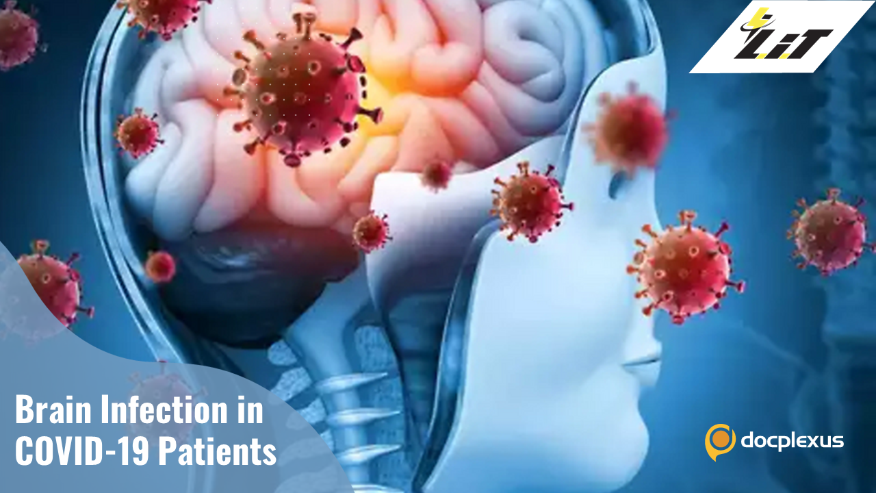 Neurological Target of COVID-19