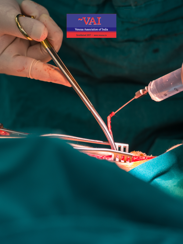 Why and How to Not Destroy the Great Saphenous Vein