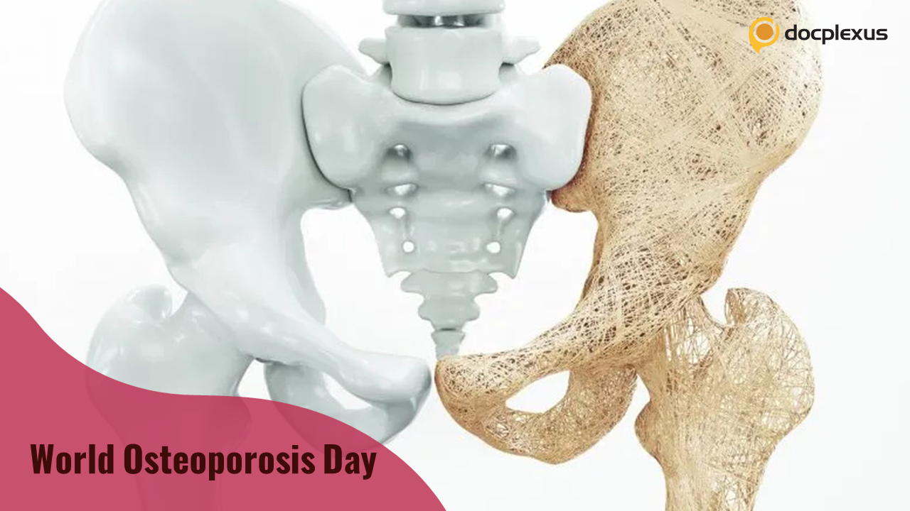 Osteoporosis Quiz: Step Up for Bone Health
