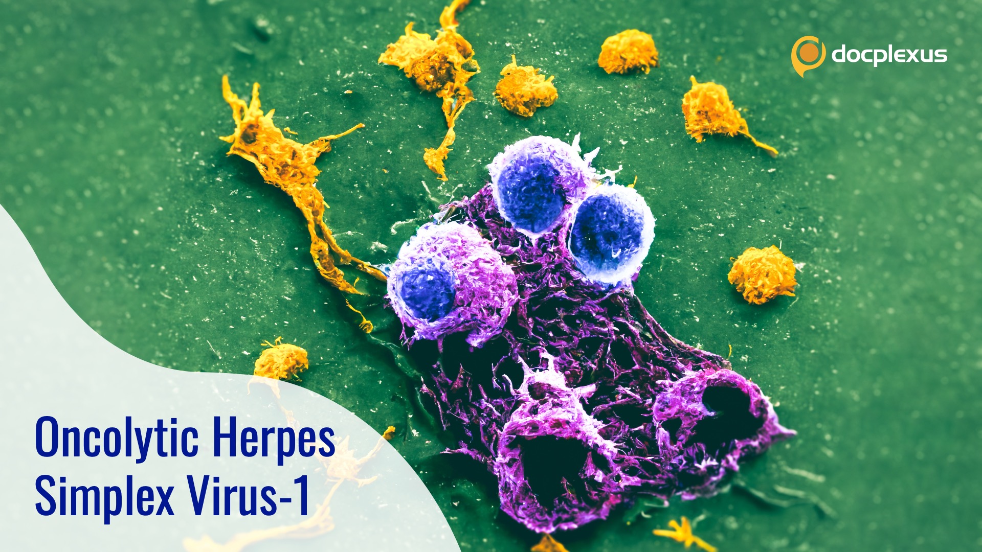 A Promising Cancer-killing Virus