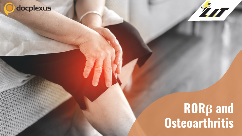 New Targets for Osteoarthritis