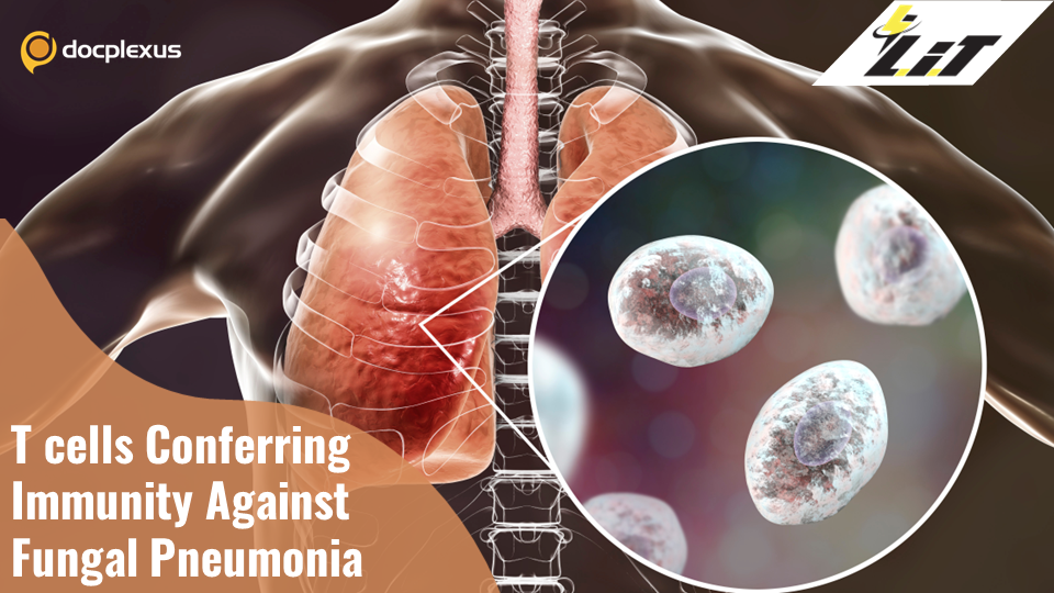 T cells Help Bolster Vaccine Immunity Against Fungal Pneumonia