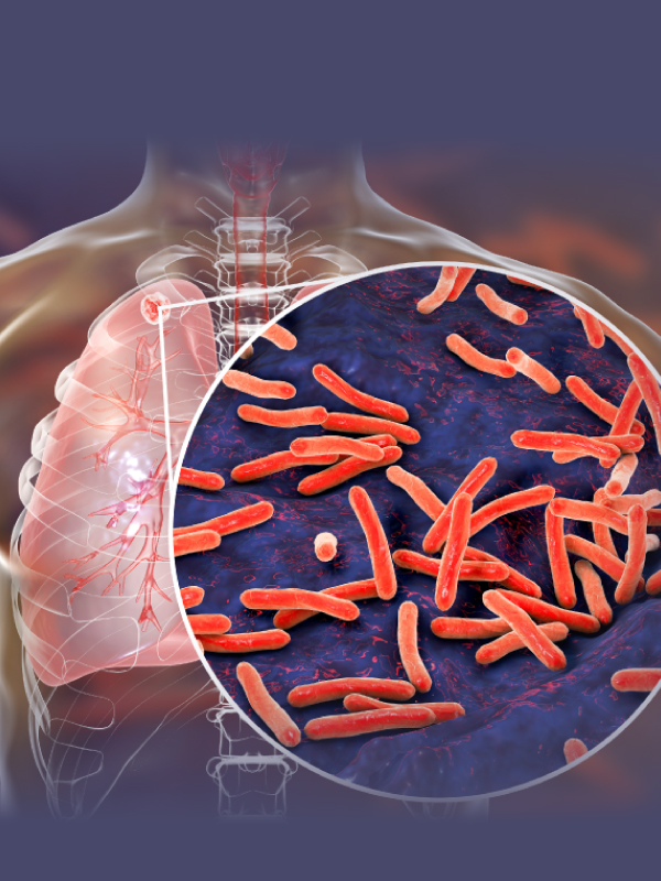 Journey Towards Tuberculosis Elimination in India