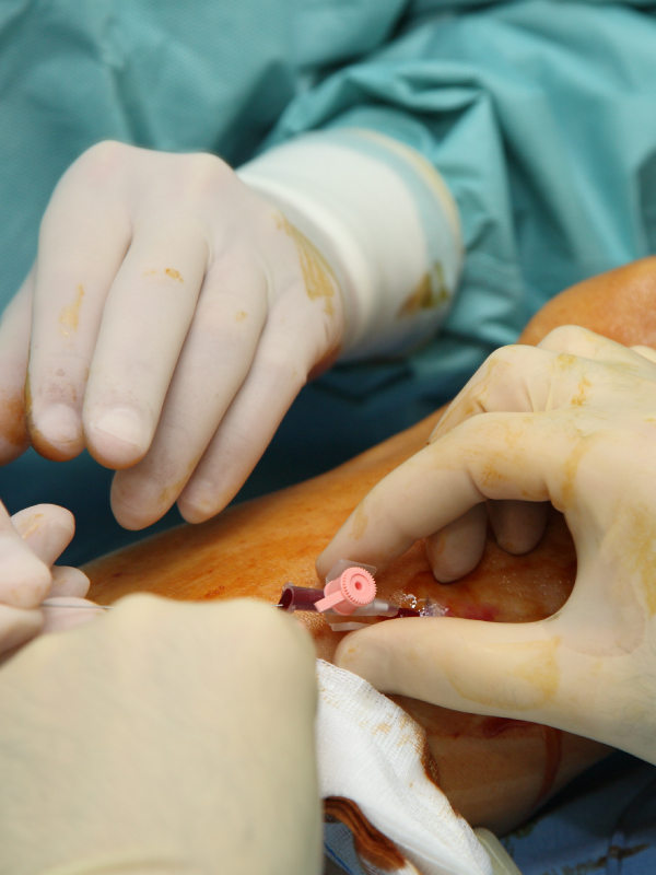 Venous Problems Faced by General Physicians in Everyday Practice