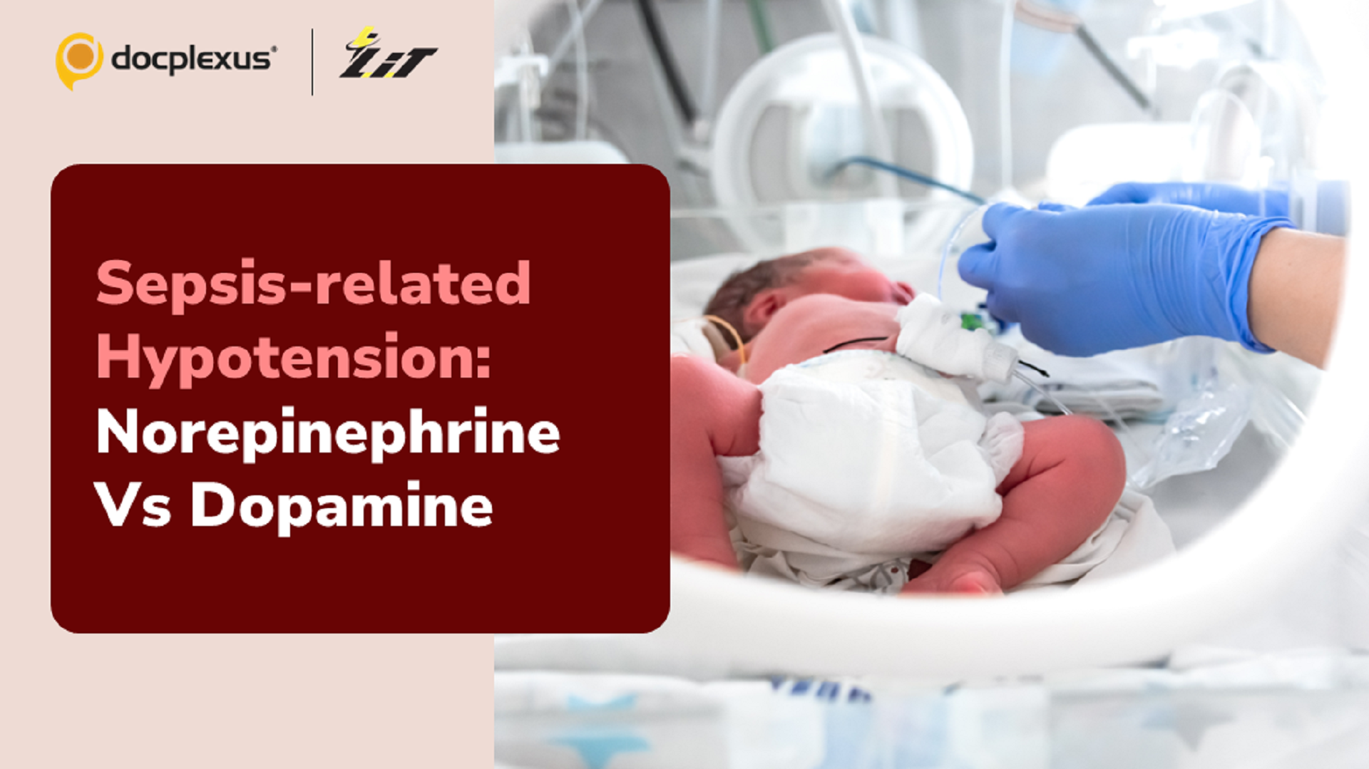 Norepinephrine or Dopamine – Which one is Better for Sepsis-related Hypotension?