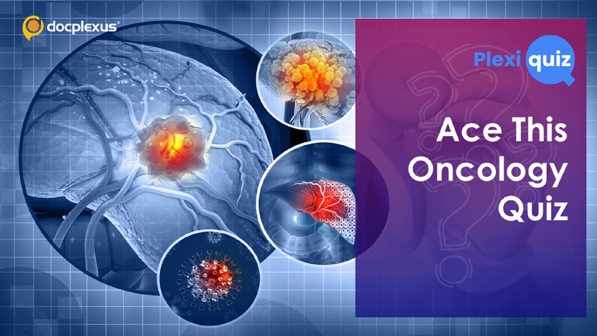 Take this Quiz on Multiple Myeloma, HCC & Liver Surgery for Cancer