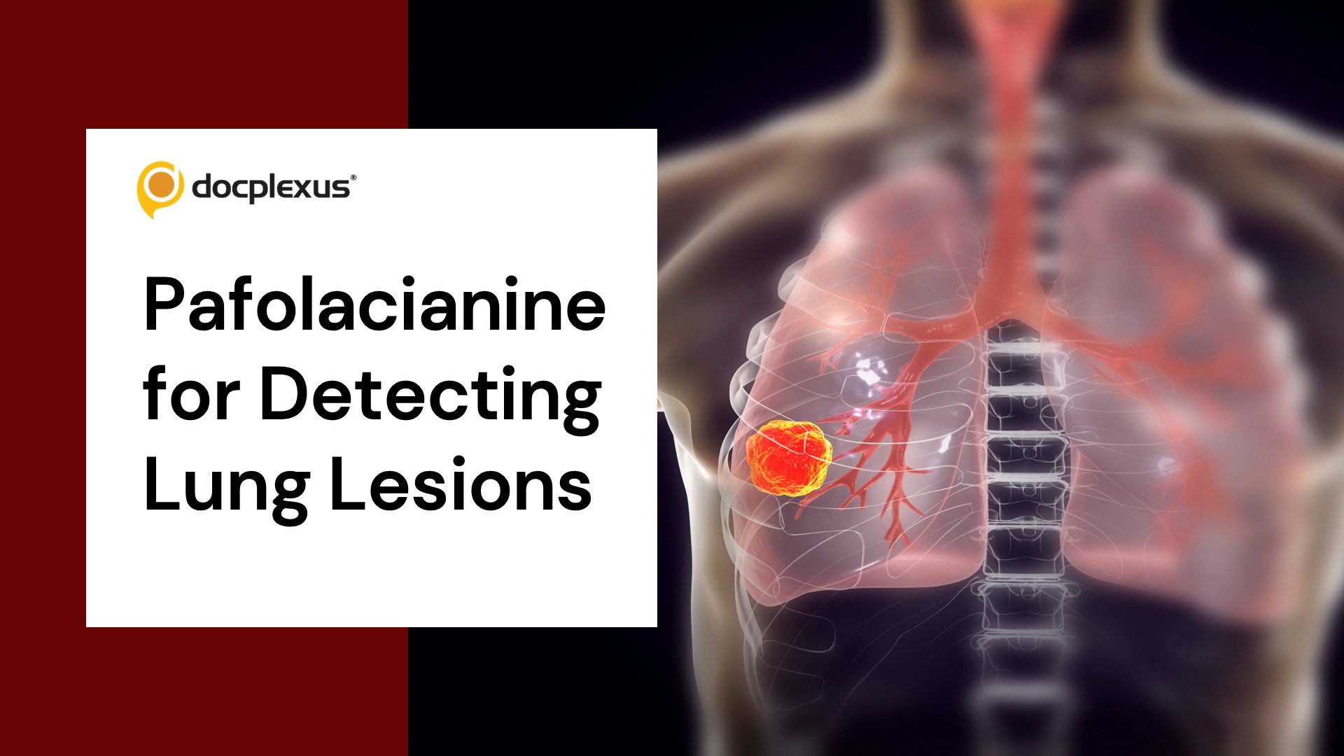 USFDA Approves Imaging Agent to Identify Difficult-to-detect Lung Lesions