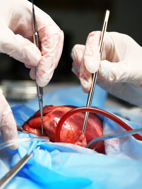 Towards Less Invasive Cardiac Surgery