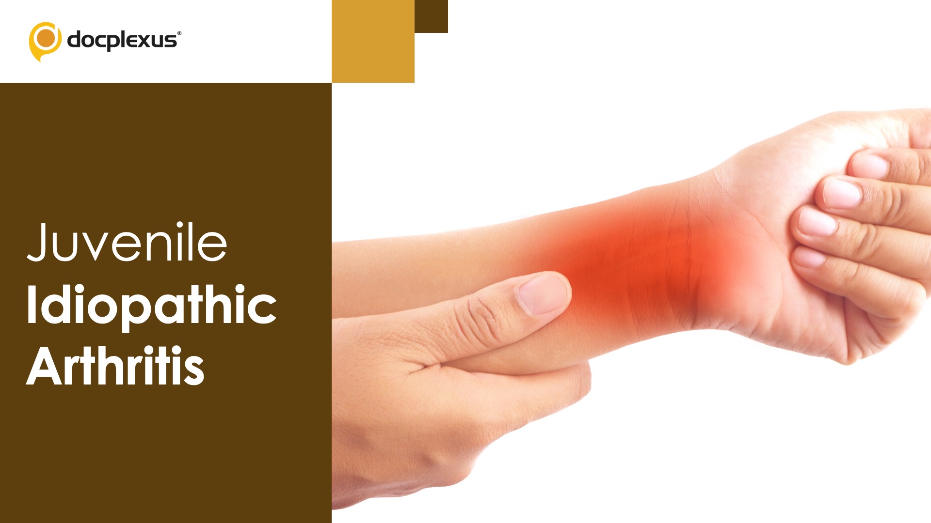 Help Your Patients Understand Juvenile Idiopathic Arthritis