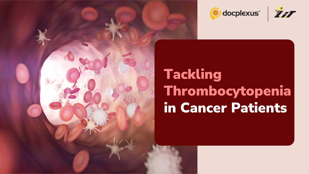 Life-saving Therapy for Low Platelets in Cancer Patients