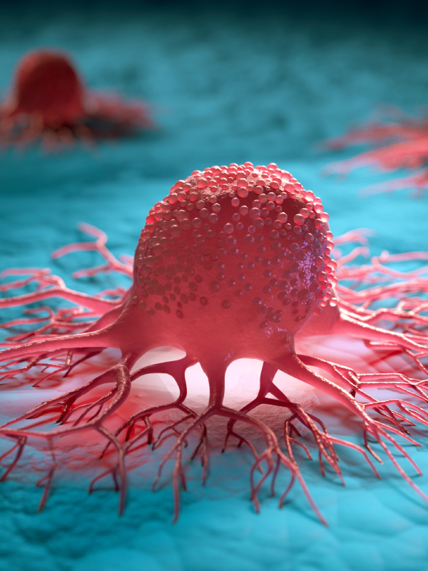 Diet, Surgery, and Changing Paradigms in Cancer