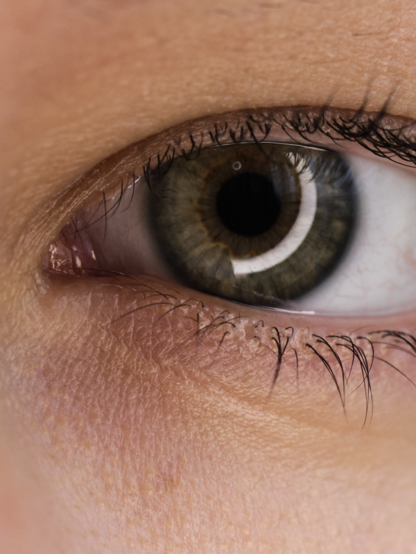 Diabetic Retinopathy